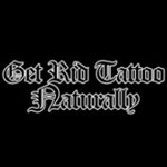 Get Rid Tattoo